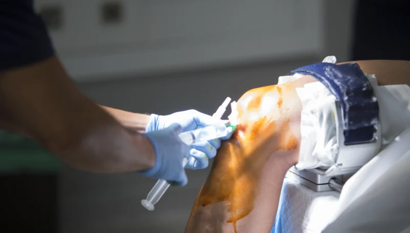 Arthroscopy procedure