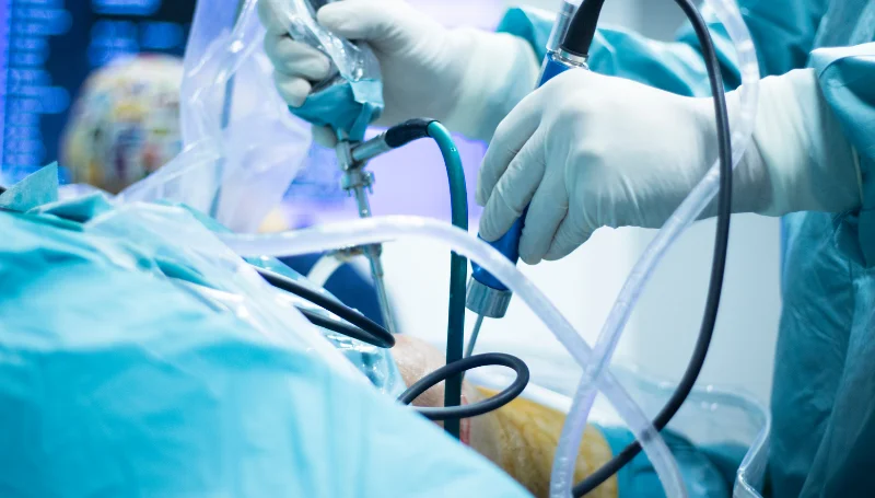 best arthroscopy surgeon in Gaya