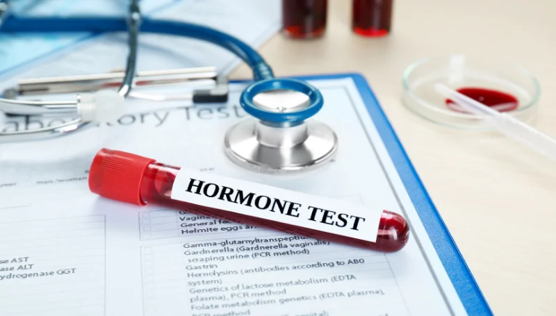 hormone test