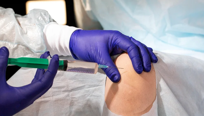 Intra-articular corticosteroid injections