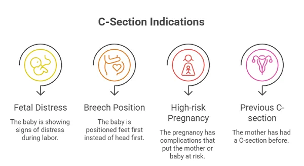 C-section indicators