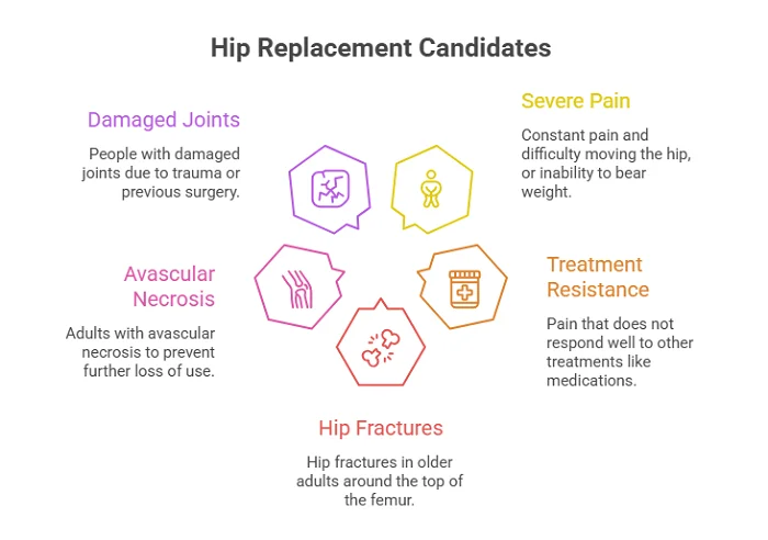 Who Needs Hip Replacement Surgery