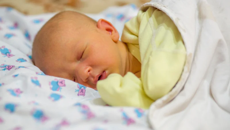 Newborn Jaundice Signs