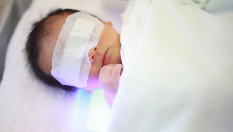 Newborn Jaundice Treatment