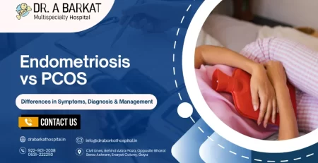 Endometriosis vs PCOS