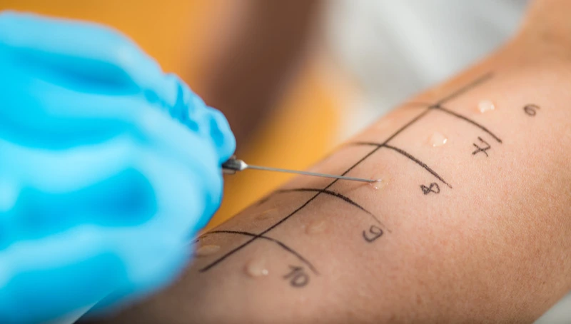 How Is Allergy Testing Performed in Gaya?