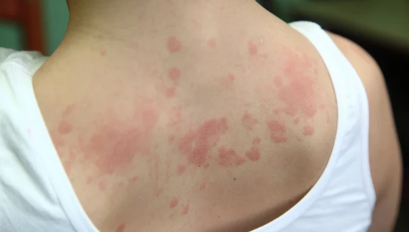 When Does a Child Need Allergy Testing?